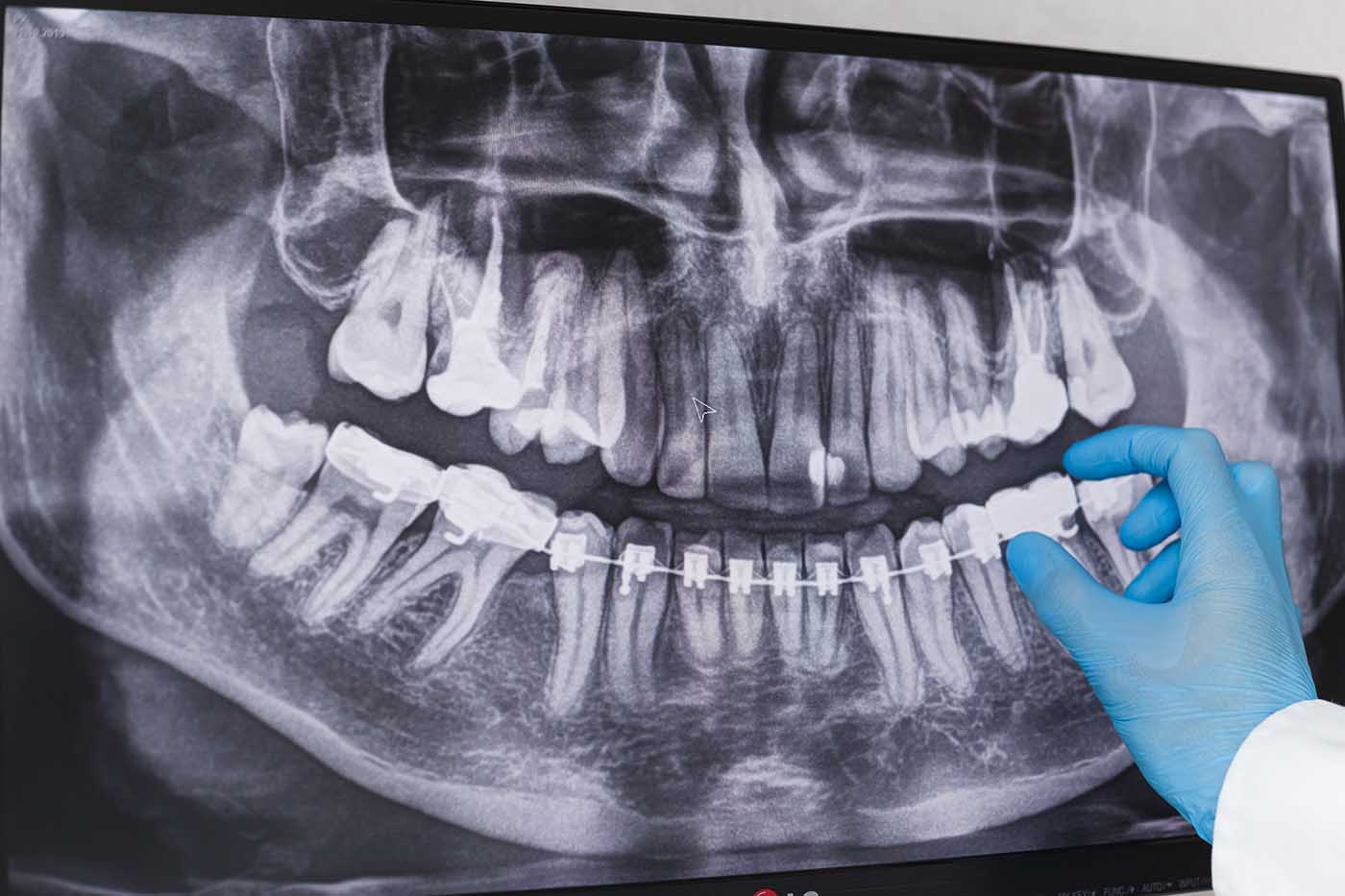 how-much-does-dental-insurance-cost-skills-media